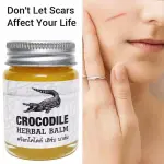 Thai Herbal Balm Scar Removal Cream